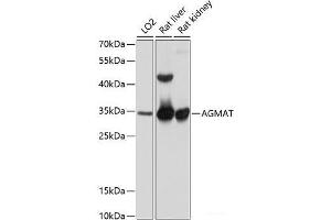 Western blot analysis of extracts of various cell lines using AGMAT Polyclonal Antibody at dilution of 1:1000. (AGMAT anticorps)