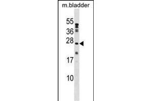 PTP4A1 Antibody (C-term) (ABIN1536716 and ABIN2848589) western blot analysis in mouse bladder tissue lysates (35 μg/lane). (PTP4A1 anticorps  (C-Term))