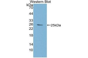 Western Blotting (WB) image for anti-B-Cell CLL/lymphoma 9 (BCL9) (AA 1119-1328) antibody (ABIN1980369) (BCL9 anticorps  (AA 1119-1328))