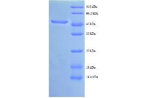 C-Abl Oncogene 1, Non-Receptor tyrosine Kinase (ABL1) (AA 4-194), (partial) protein (GST tag)