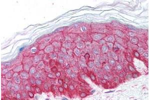Human Skin (formalin-fixed, paraffin-embedded) stained with ACTB antibody ABIN213653 at 5 ug/ml followed by biotinylated goat anti-rabbit IgG secondary antibody ABIN481713, alkaline phosphatase-streptavidin and chromogen. (beta Actin anticorps  (C-Term))