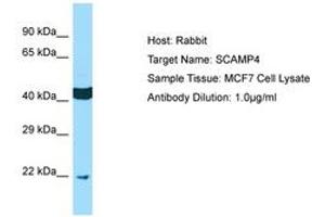 Image no. 1 for anti-Secretory Carrier Membrane Protein 4 (SCAMP4) (AA 41-90) antibody (ABIN6750134) (SCAMP4 anticorps  (AA 41-90))