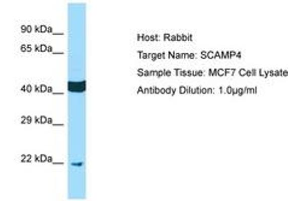 SCAMP4 Antikörper  (AA 41-90)