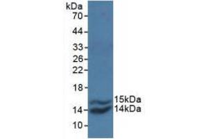 Western blot analysis of recombinant Simian MCP1. (CCL2 anticorps  (AA 24-99))