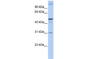 WB Suggested Anti-ACBD5 Antibody Titration:  0. (ACBD5 anticorps  (N-Term))
