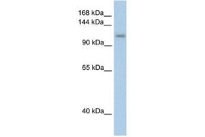 PRPF6 antibody used at 2. (PRP6/ANT-1 anticorps)