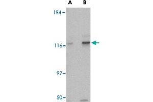Western blot analysis of KIF5A in K-562 cell lysate with KIF5A polyclonal antibody  at (A) 0. (KIF5A anticorps  (AA 330-380))