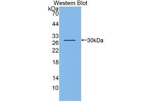 Western blot analysis of the recombinant protein. (Fibulin 1 anticorps  (AA 176-398))