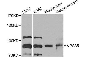 Western blot analysis of extracts of various cell lines, using VPS35 antibody. (VPS35 anticorps  (AA 1-250))