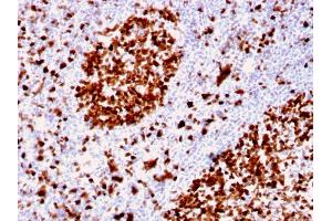 Formalin-fixed, paraffin-embedded human Tonsil stained with MCM6 Mouse Monoclonal Antibody (MCM6/2999).