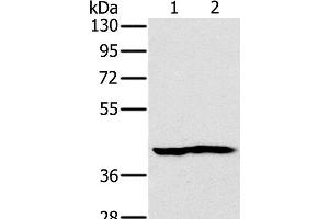 Western Blot analysis of Mouse heart and kidney tissue using NDUFA10 Polyclonal Antibody at dilution of 1:450 (NDUFA10 anticorps)