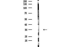 anti-Neurogenic Differentiation 6 (NEUROD6) (Internal Region) antibody