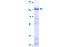 Image no. 1 for Kruppel-Like Factor 4 (Gut) (KLF4) (AA 1-470) protein (GST tag) (ABIN1308754)