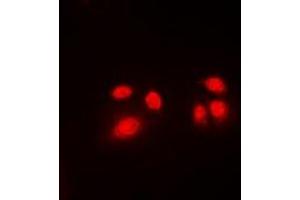Immunofluorescent analysis of CBFB staining in Jurkat cells. (CBFB anticorps  (N-Term))