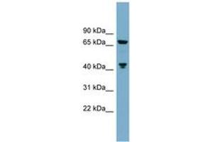 Image no. 1 for anti-Glutaminase (GLS) (C-Term) antibody (ABIN6743797)