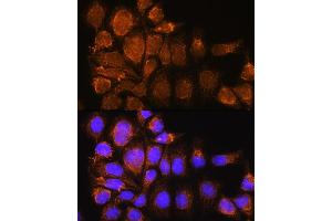 Immunofluorescence analysis of HeLa cells using SYNE3 Rabbit pAb (ABIN6131129, ABIN6148766, ABIN6148767 and ABIN6217163) at dilution of 1:100.