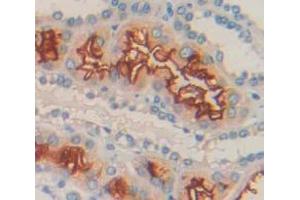 Used in DAB staining on fromalin fixed paraffin- embedded Kidney tissue