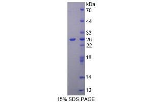 SDS-PAGE (SDS) image for Keratin 1 (KRT1) (AA 350-488) protein (His tag) (ABIN1099219) (Cytokeratin 1 Protein (AA 350-488) (His tag))