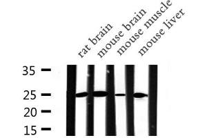 Western blot analysis of APOA1 expression in various lysates