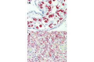 Immunohistochemical staining (Formalin-fixed paraffin-embedded sections) of human placenta (A) and human spleen (B) with FCGR2A monoclonal antibody, clone 13D7 . (FCGR2A anticorps)