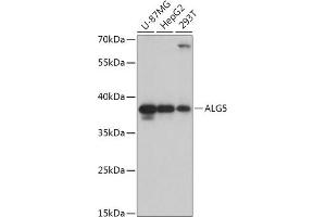 Western blot analysis of extracts of various cell lines, using  antibody (ABIN7265696) at 1:1000 dilution. (ALG5 anticorps  (AA 34-190))