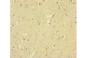 Immunohistochemistry of paraffin-embedded human brain tissue using ABIN7167522 at dilution of 1:100 (PTPRZ1 anticorps  (AA 36-300))