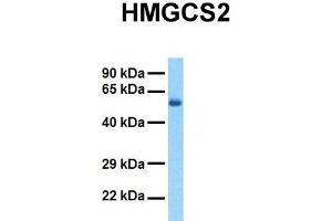Host:  Rabbit  Target Name:  HMGCS2  Sample Tissue:  Human Fetal Liver  Antibody Dilution:  1. (HMGCS2 anticorps  (N-Term))
