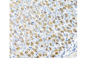 Immunohistochemistry of paraffin-embedded Mouse stomach using FECH Polyclonal Antibody at dilution of 1:100 (40x lens). (FECH anticorps)