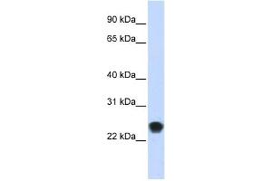 FKBP11 antibody used at 1 ug/ml to detect target protein. (FKBP11 anticorps  (N-Term))