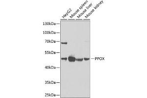 Western blot analysis of extracts of various cell lines, using PPOX Antibody (ABIN6129092, ABIN6146051, ABIN6146052 and ABIN6222026) at 1:1000 dilution. (PPOX anticorps  (AA 1-280))