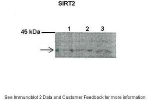 Lanes:   1. (SIRT2 anticorps  (C-Term))