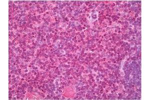 Thymus stained with Cellubrevin antibody in Immunohistochemistry on Paraffin Sections. (VAMP3 anticorps  (N-Term))