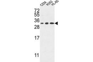 Western Blotting (WB) image for anti-Tetraspanin 2 (TSPAN2) antibody (ABIN3004129) (Tetraspanin 2 anticorps)