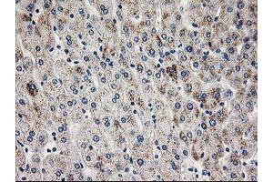 Immunohistochemical staining of paraffin-embedded Human liver tissue using anti-PGAM2 mouse monoclonal antibody. (PGAM2 anticorps)