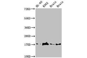 Western Blot Positive WB detected in: HL60 whole cell lysate, K562 whole cell lyaste, Mouse brain tissue, Rat brain tissue All lanes: UBE2V2 antibody at 1. (UBE2V2 anticorps  (AA 2-145))