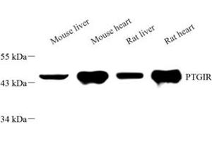 Western blot analysis of PGGIR (ABIN7075205) at dilution of 1: 2000 (Prostacyclin Receptor anticorps)