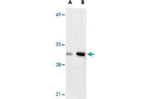 Western blot analysis of ANP32A expression in human Raji cell lysate with ANP32A polyclonal antibody  at 2 ug/mL (lane A) and 4 ug/mL (lane B), respectively. (PHAP1 anticorps  (C-Term))