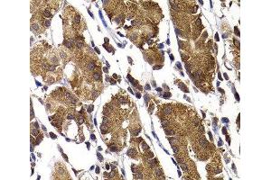 Immunohistochemistry of paraffin-embedded Human stomach using STAMBP Polyclonal Antibody at dilution of 1:100 (40x lens). (STAMBP anticorps)