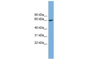 WB Suggested Anti-TBC1D24 Antibody Titration: 0.
