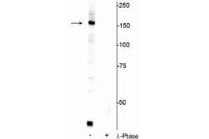 Western blot of HeLa cell lysate showing specific immunolabeling of the ~150 kDa FANCI protein phosphorylated at Ser556 in the first lane (-). (FANCI anticorps  (pSer556))