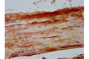 IHC image of ABIN7163404 diluted at 1:500 and staining in paraffin-embedded human skeletal muscle tissue performed on a Leica BondTM system.