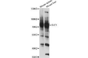 Western blot analysis of extracts of various cell lines, using GLE1 antibody (ABIN6293108) at 1:3000 dilution. (GLE1 anticorps)