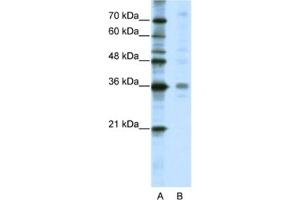 Western Blotting (WB) image for anti-Mediator Complex Subunit 27 (MED27) antibody (ABIN2461720) (MED27 anticorps)
