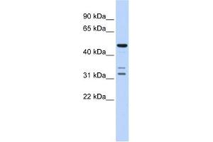 HTRA4 antibody used at 1 ug/ml to detect target protein. (HTRA4 anticorps  (Middle Region))