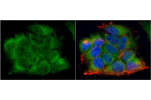 ICC/IF Image LDHA antibody detects LDHA protein at cytoplasm by immunofluorescent analysis.