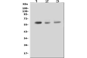 Western blot analysis of RUNX2 using anti-RUNX2 antibody (ABIN3043708).