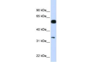 WB Suggested Anti-C19orf62 Antibody Titration: 0. (BRISC and BRCA1 A Complex Member 1 (BABAM1) (N-Term) anticorps)