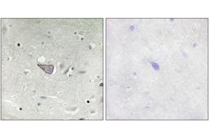 Immunohistochemistry (IHC) image for anti-Armadillo Repeat Containing, X-Linked 3 (ARMCX3) (AA 291-340) antibody (ABIN2889794) (ARMCX3 anticorps  (AA 291-340))