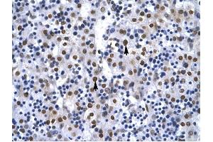 G22P1 antibody was used for immunohistochemistry at a concentration of 4-8 ug/ml to stain Hepatocytes arrows) in Human Liver. (XRCC6 anticorps  (N-Term))
