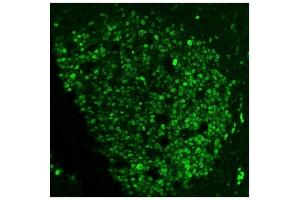 IF analysis of Ki67 using anti-Ki67 antibody (ABIN7601100). (Ki-67 anticorps  (AA 2860-3256))